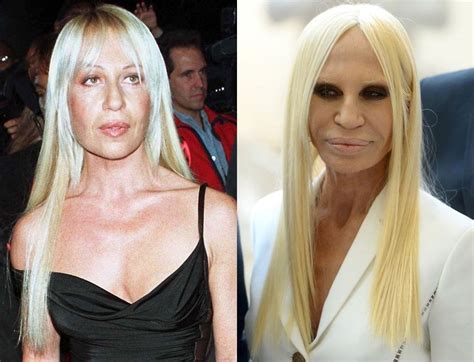 donatella versace no plastic surgery|versace sister plastic surgery.